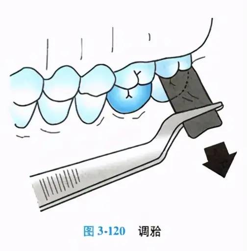 牙科医生讲义第十九讲： 牙体缺损修复体粘接、粘固与完成的流程